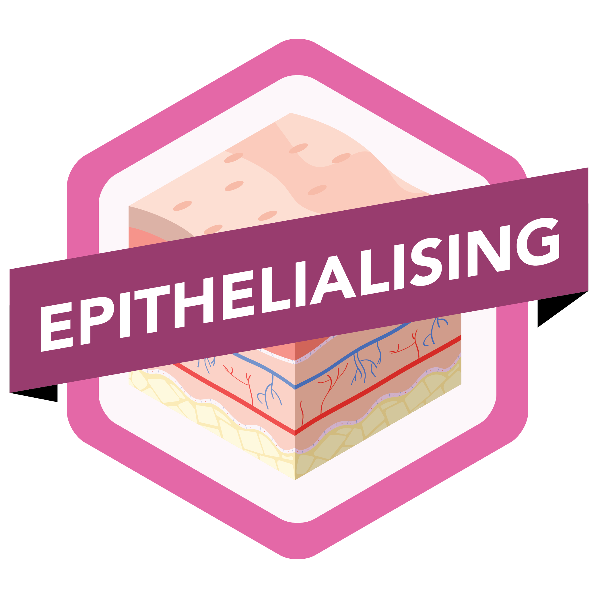 Epithelialising